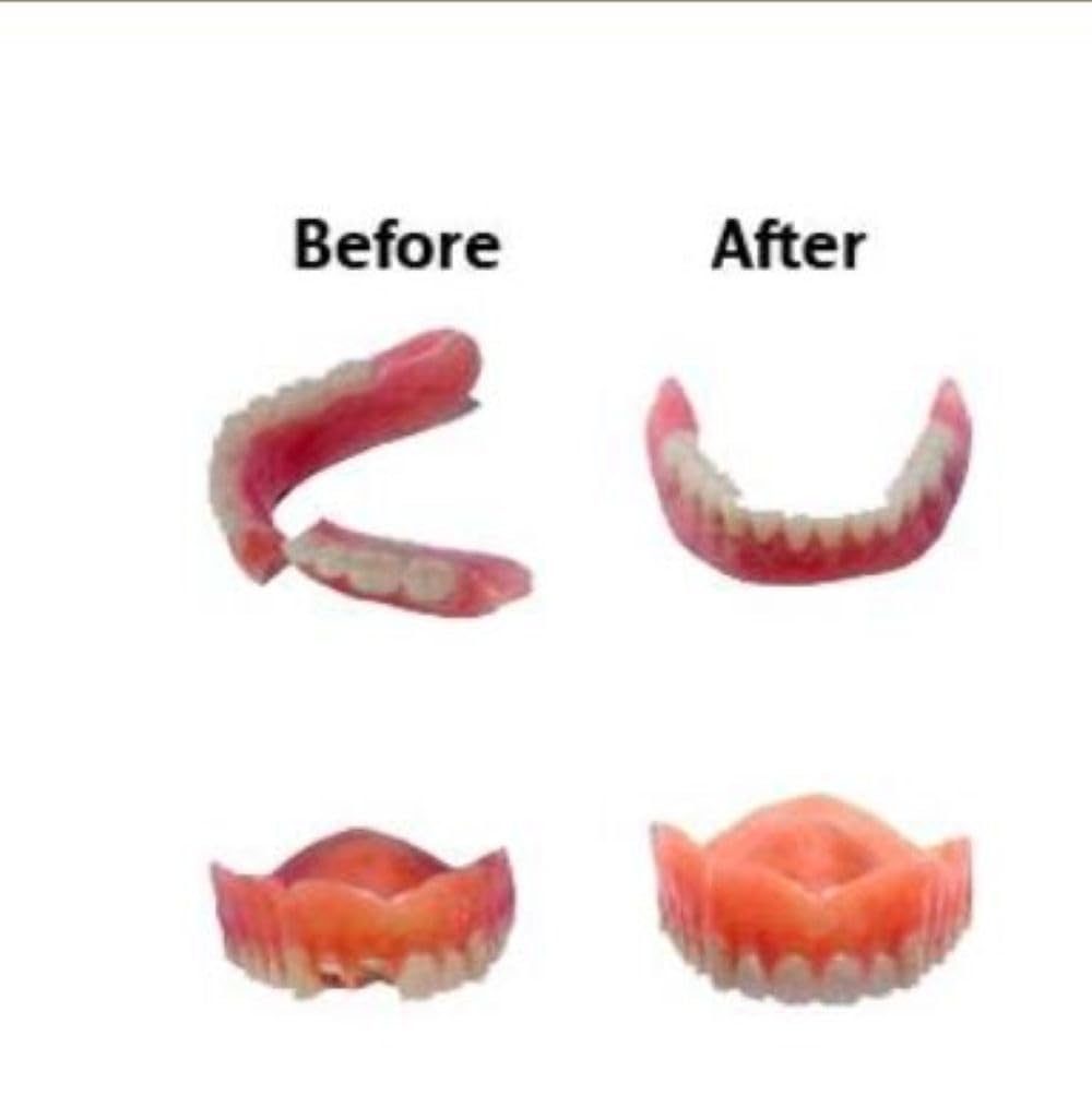 Professional Grade Denture Repair Kit Glue N7159