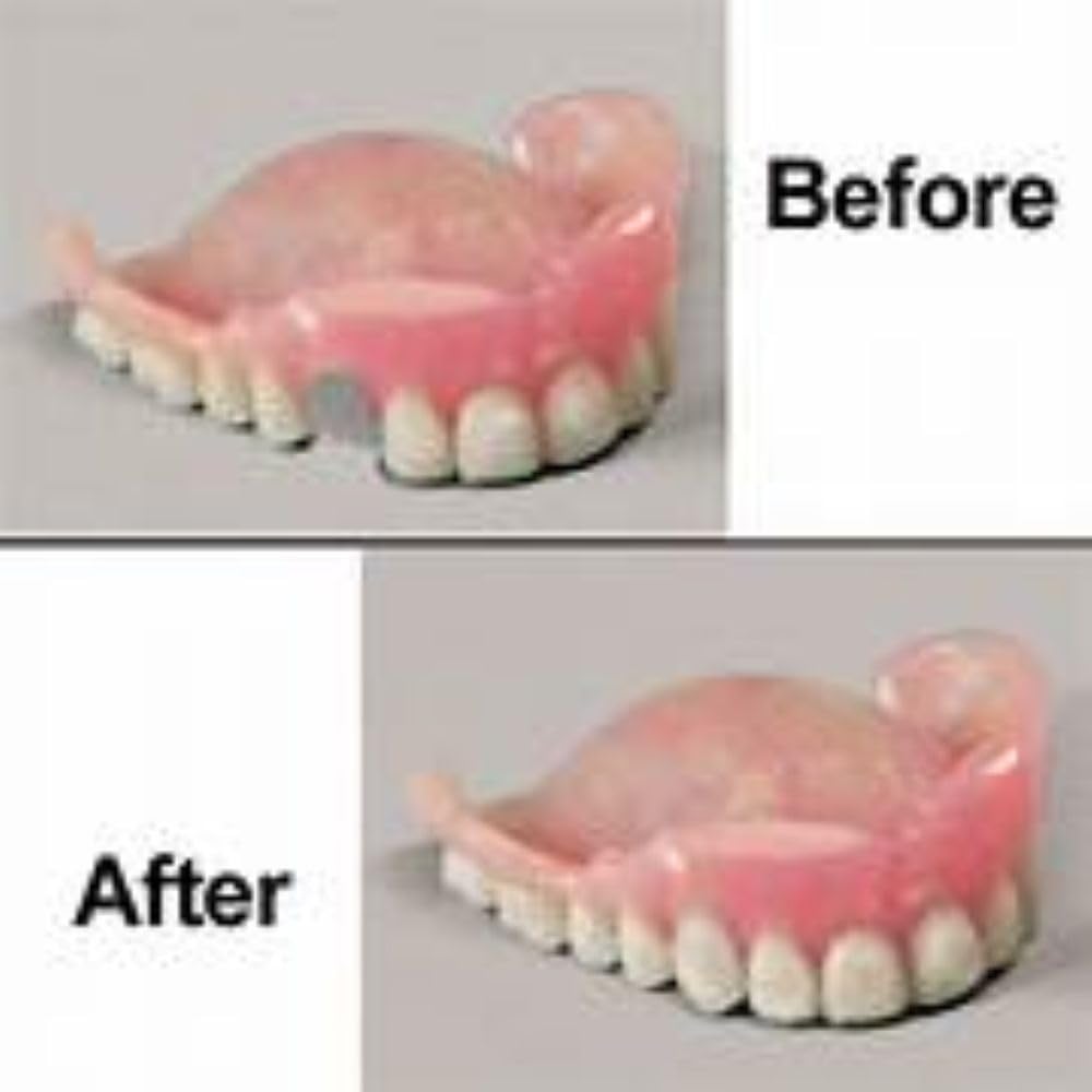 Professional Grade Denture Repair Kit Glue N7159